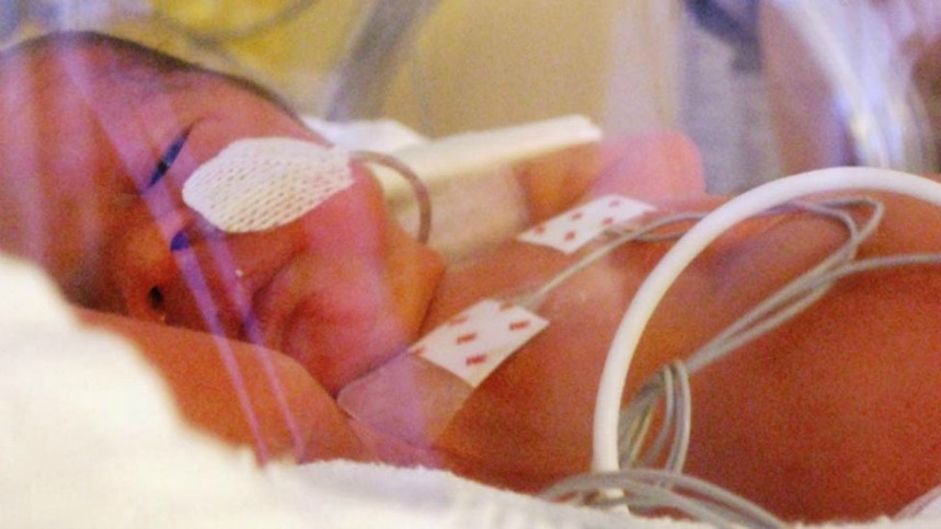 Un bebé vive gracias a un corazón impreso en 3D