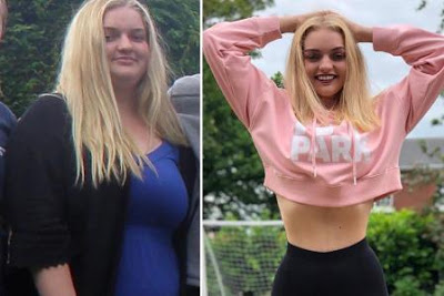 Padecía de sobrepeso,pero cansada del Bullying decidió bajar 62 kilos
