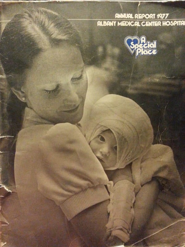 En 1977 una enfermera cuidó a esta bebé quemada y 38 años después sucedió esto
